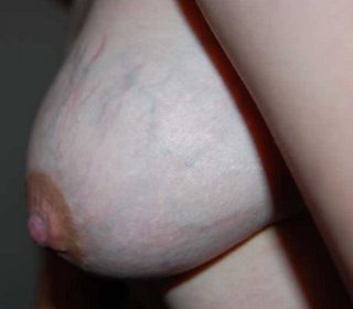 milk fed breasts