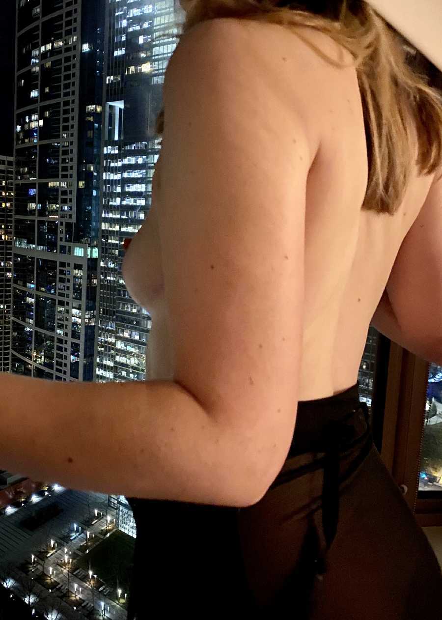 Flashing at the Hotel Window