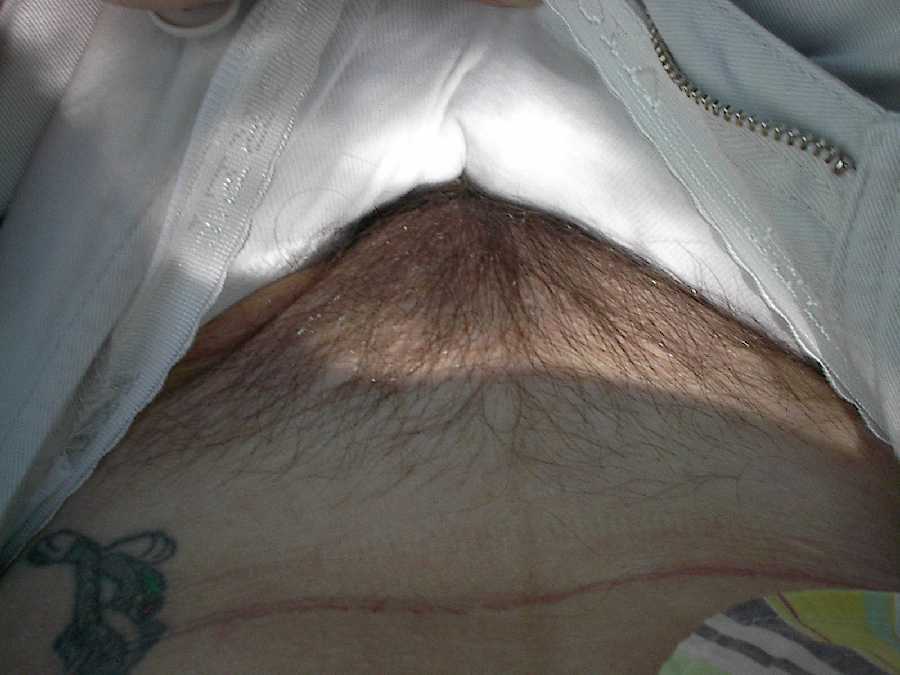 Pubes